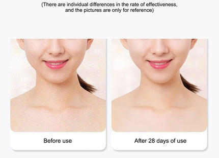 Mini Facial Toning Device Συσκευή Περιποίησης Προσώπου LED & Υπερύθρων για Αντιγήρανση